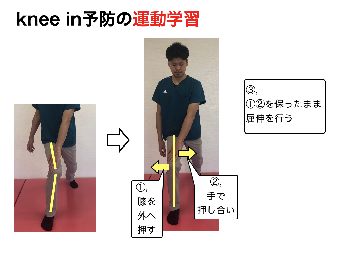 knee in予防運動学習