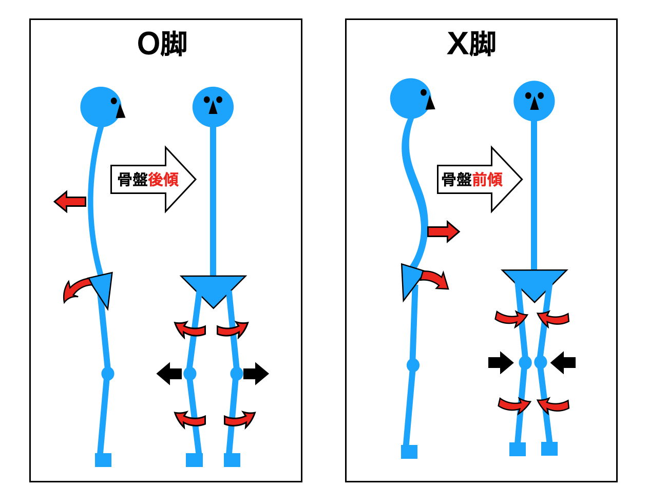 変形性膝関節症やO脚による膝内側の痛みの原因と対策方法 | 障害予防推進会